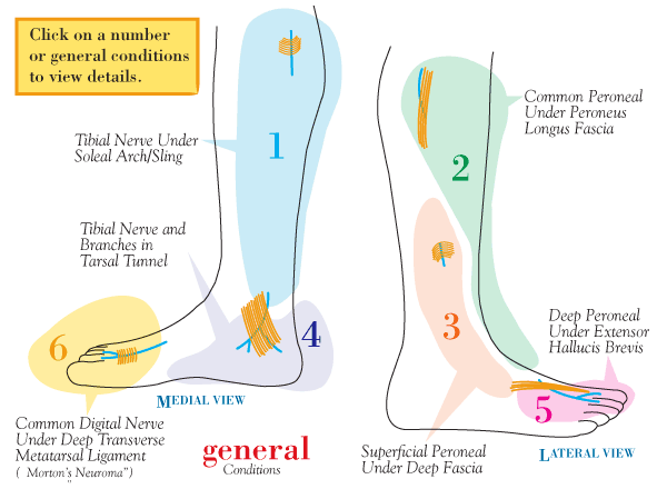 Nerve Pain: Nerve Pain Heel Of Foot