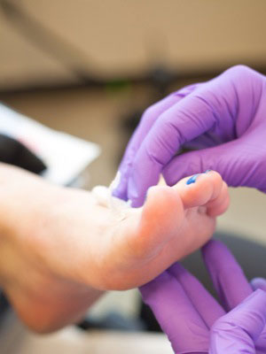AFAS foot closeup AFAS foot closeup